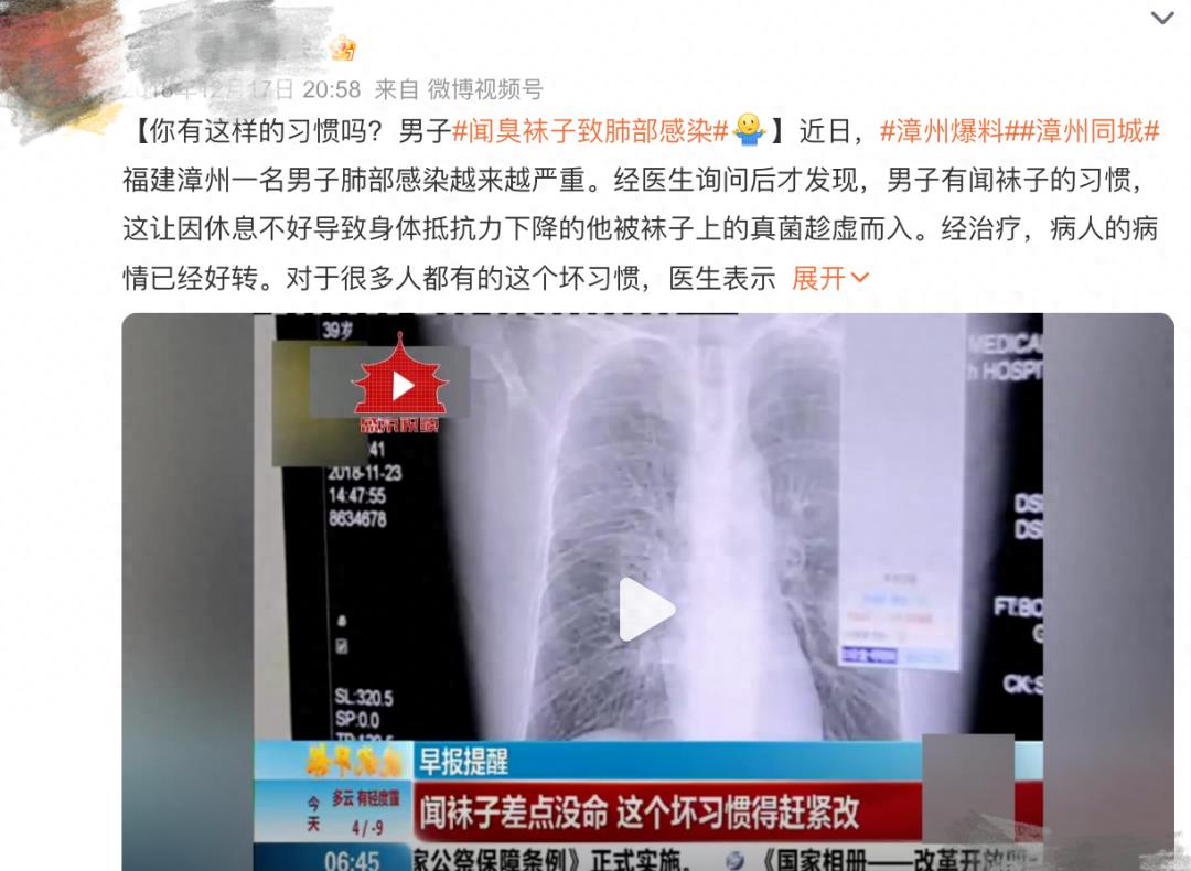 好变态啊，竟有超过91%的人爱闻自己身上这个部位