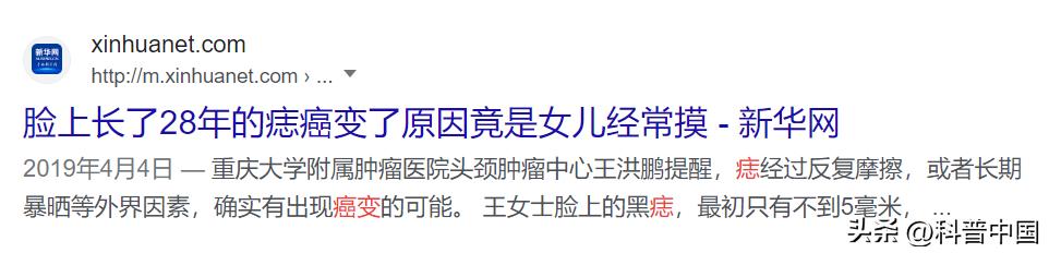 怎么判断身上的痣变癌,痣的病变到癌需要多长时间