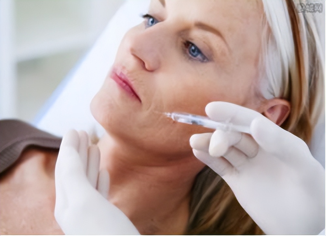 去除老年斑最有效的药膏,用什么药膏治疗老年斑最有效