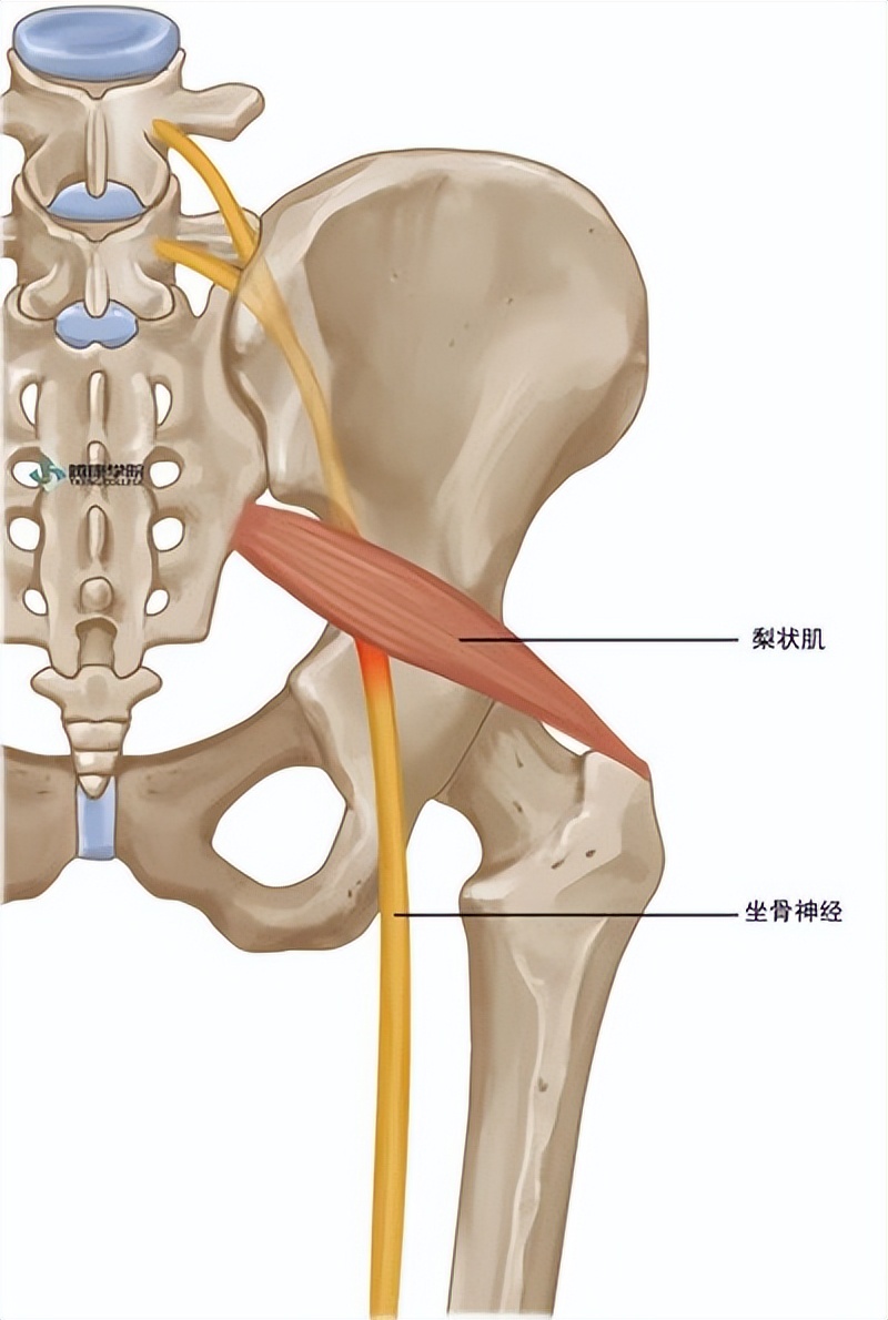 臀部痛和小腿痛怎么回事,臀部痛和大腿痛是股骨头坏死吗