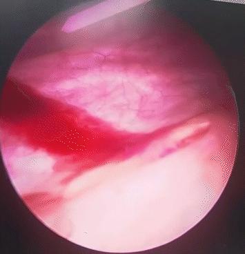 #健康中国行动2030#不明原因尿血7个月，一条热搜治好了她的病