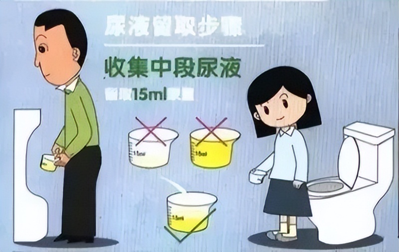 尿检怎样正确留取尿标本,做尿常规检查时最适合留哪种标本