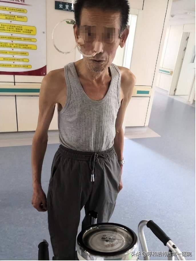 消化内科与消化内镜微创手术,贲门失弛缓症消化内科手术全过程