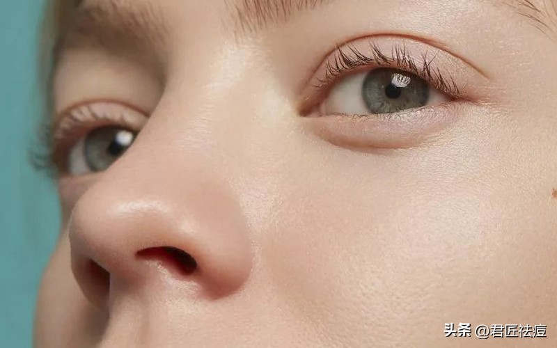 鼻子长痘痘怎么办最有效,鼻子上长痘痘的最好解决方法