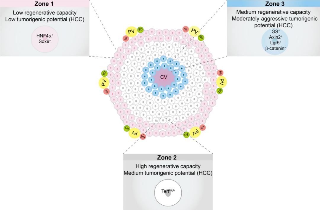 肝脏癌早期的6个表现,肝损伤会发展成肝癌吗