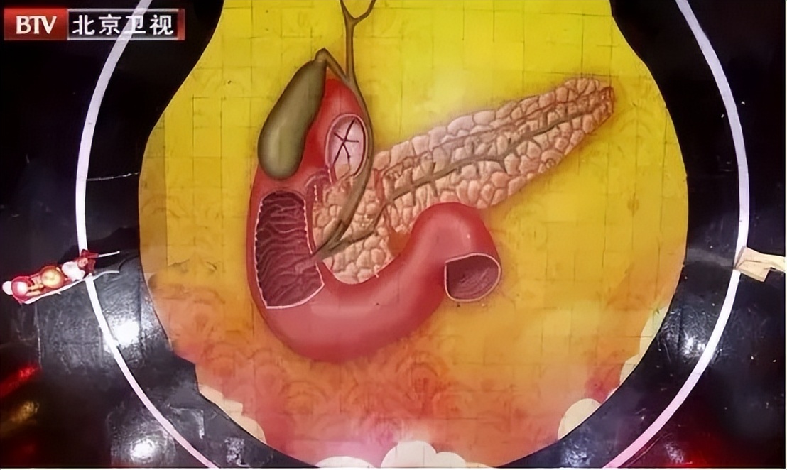 人体最脆弱的6个部位，伤到哪个都有致命的风险