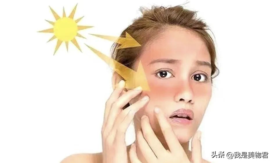 太阳把皮肤晒坏了怎么修复,晒后皮肤痒如何修复
