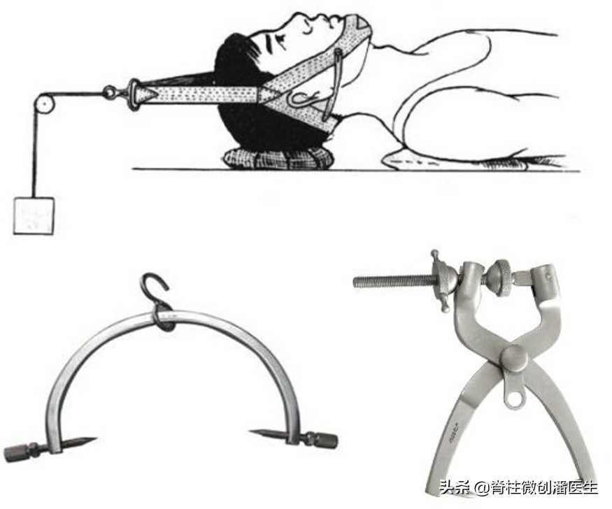 宝宝脖子右歪应该往哪看,百天宝宝脖子光往一边歪