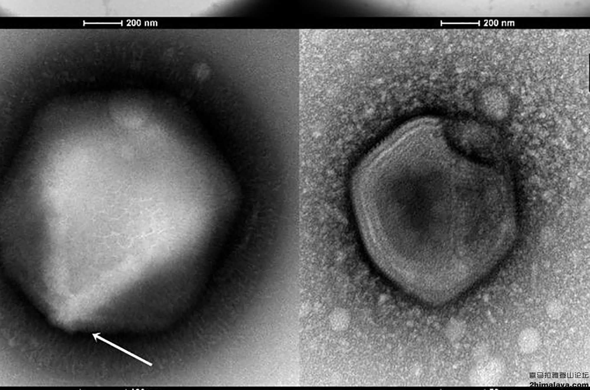 俄罗斯真的有僵尸病毒吗 (俄罗斯感染了僵尸病毒了吗)