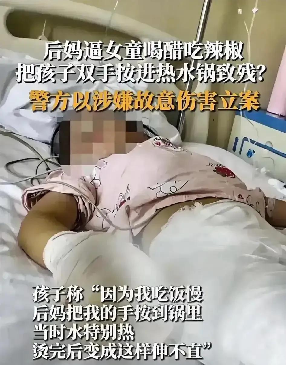4岁女童被继母虐打生命垂危,女童遭虐待致伤