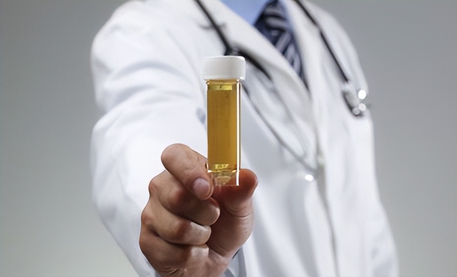 尿常规就能看出肾有问题吗,手把手教你看懂尿常规