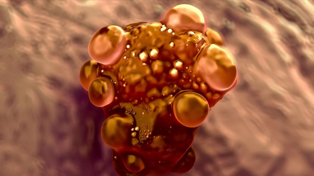 大蒜是“抗癌之王”,每周生吃2次可降低一半肺癌风险?是真是假