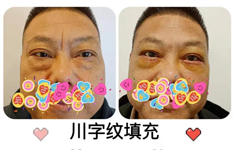 夏天美容整形,医院美容护肤项目