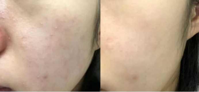 十大公认好用的孕妇水乳明星同款,有哪些平价又好用的孕妇水乳