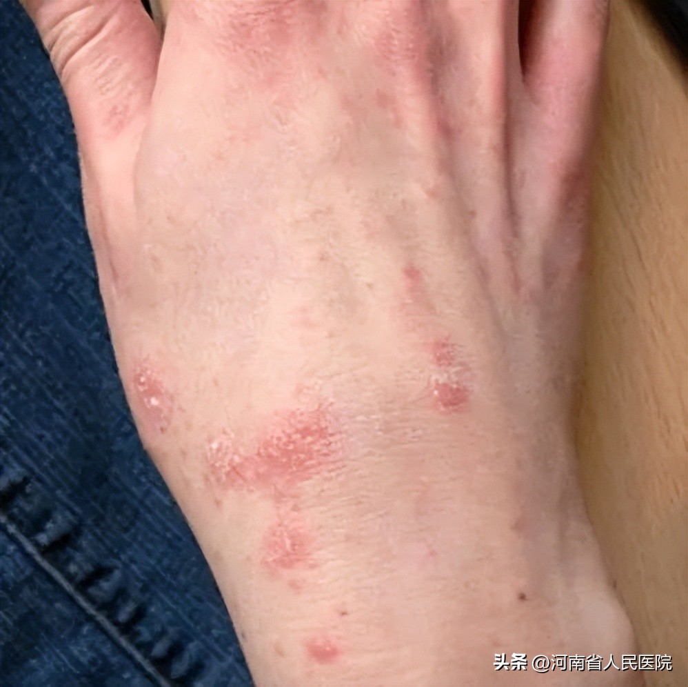 医生画鬼画符,医生鬼画符视频