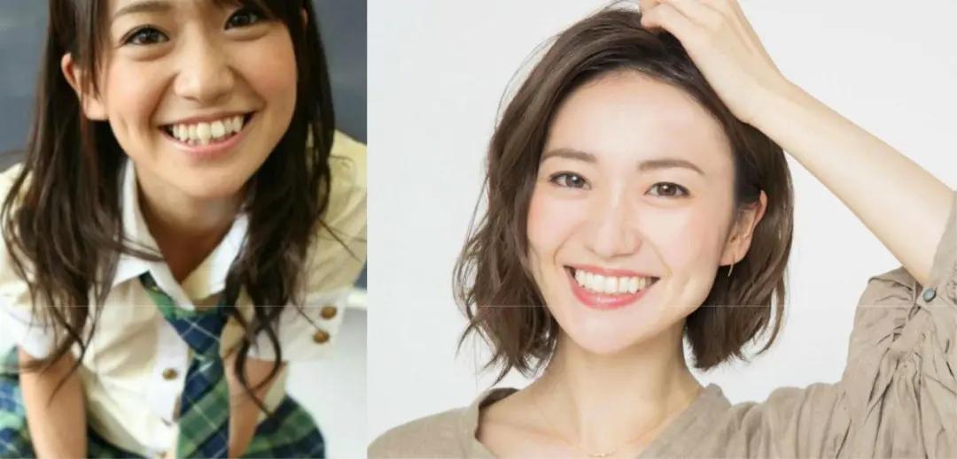 日本整牙的明星,日本整牙明星