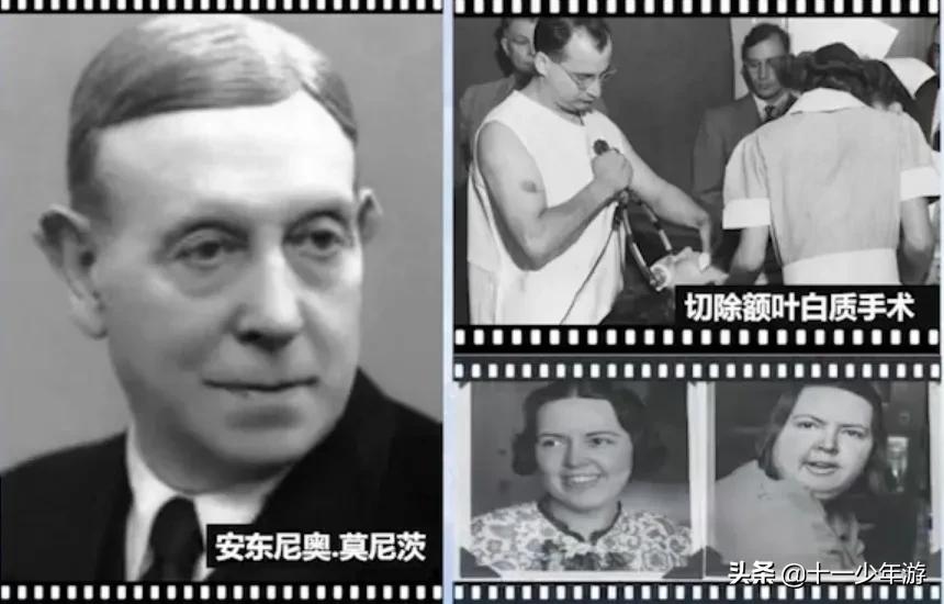 大脑的结构解剖示意图,大脑镰下疝解剖结构