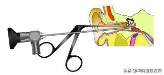 打一巴掌耳膜穿孔严重算犯罪么,一巴掌导致鼓膜穿孔