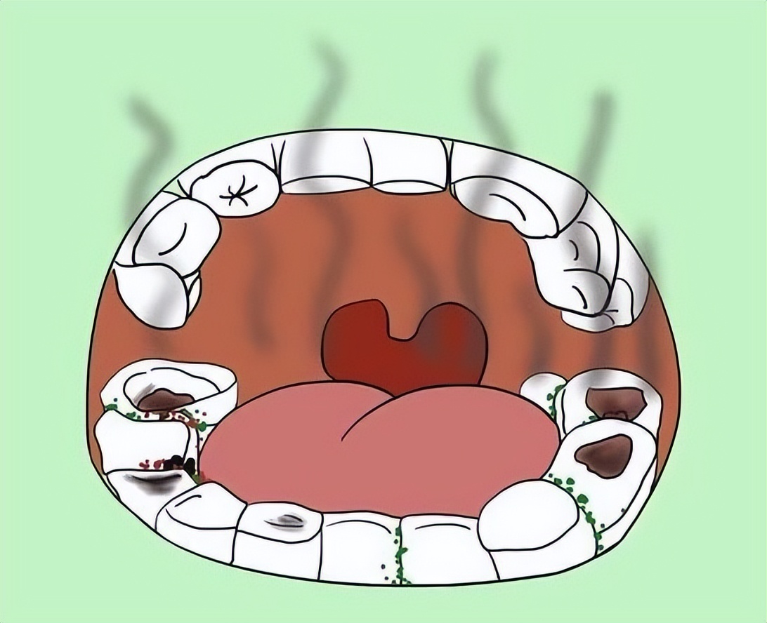嘴里有酸臭味吃什么药,嘴里有酸甜苦咸味是怎么回事