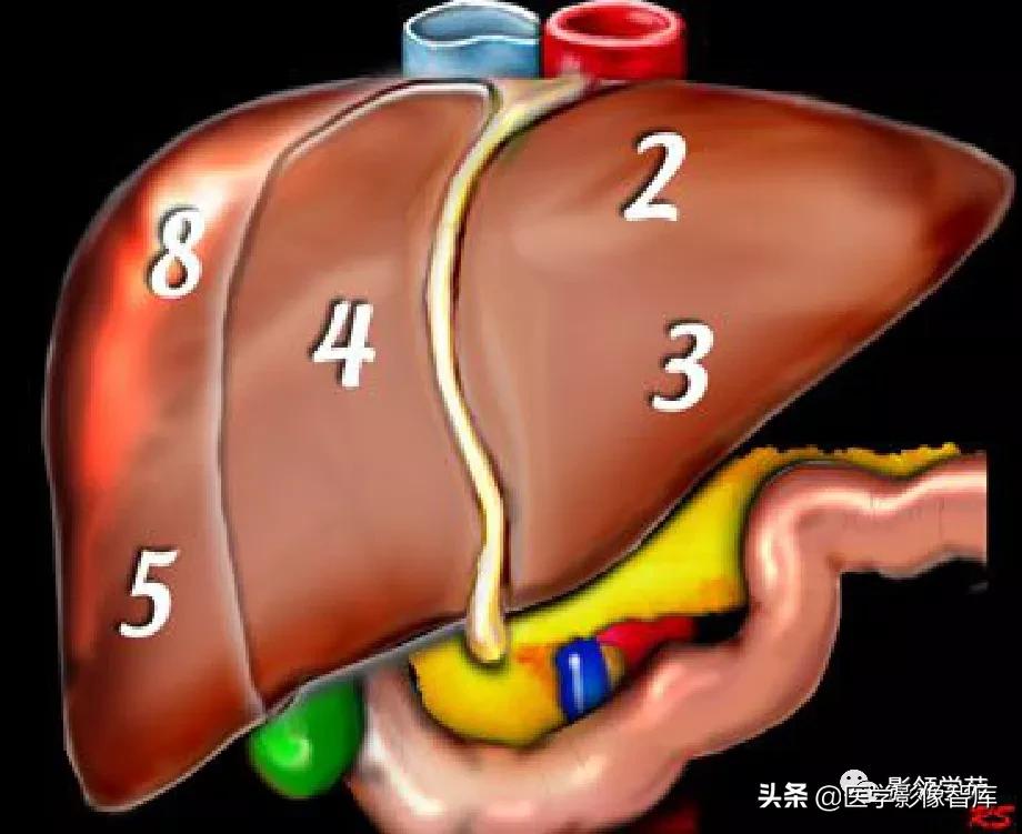 肝脏影像分叶分段解剖图,肝脏分段解剖图谱