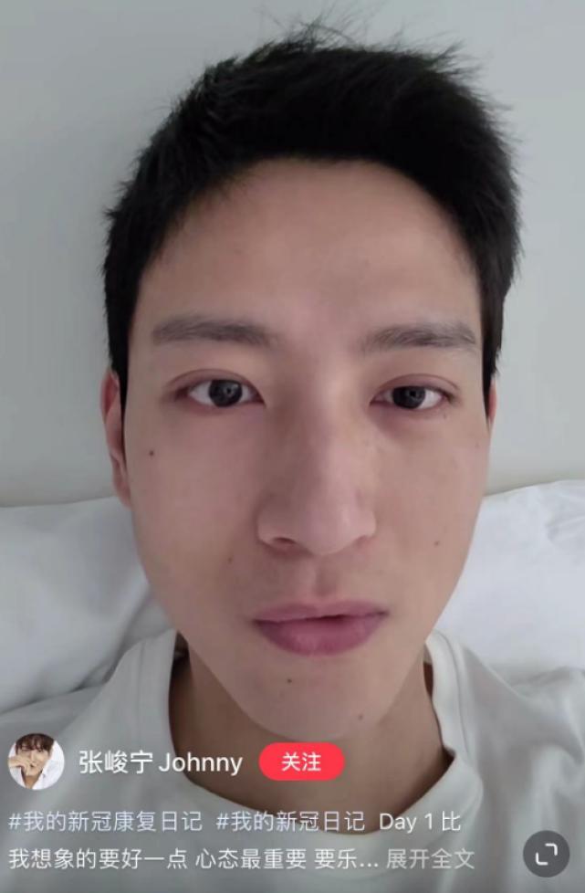 朱军妻子感染新冠，怕传染家人在家戴口罩，高烧39度嗓子发炎