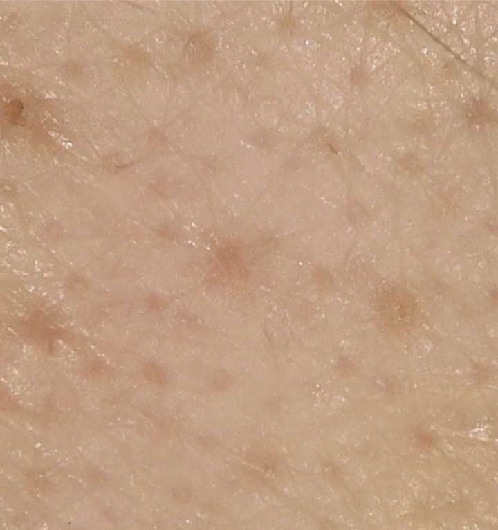 卸粉底后感觉鼻子上的毛孔有白点,为什么上完粉底液鼻子上有黑点