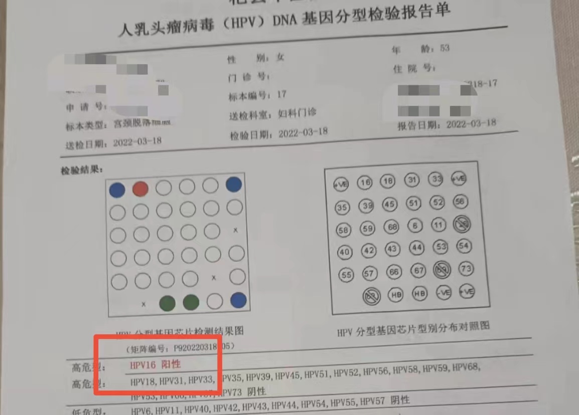 宫颈癌的4个常识,宫颈癌很可怕三个步骤教你预防