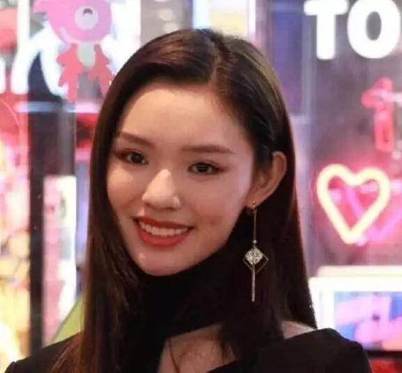 明星做烤瓷牙变凸嘴,明星烤瓷牙凸嘴