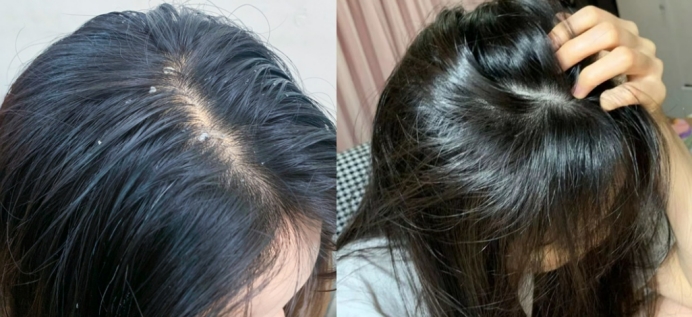 什么洗发水控油不脱发,适合妈妈用的防脱发洗发水