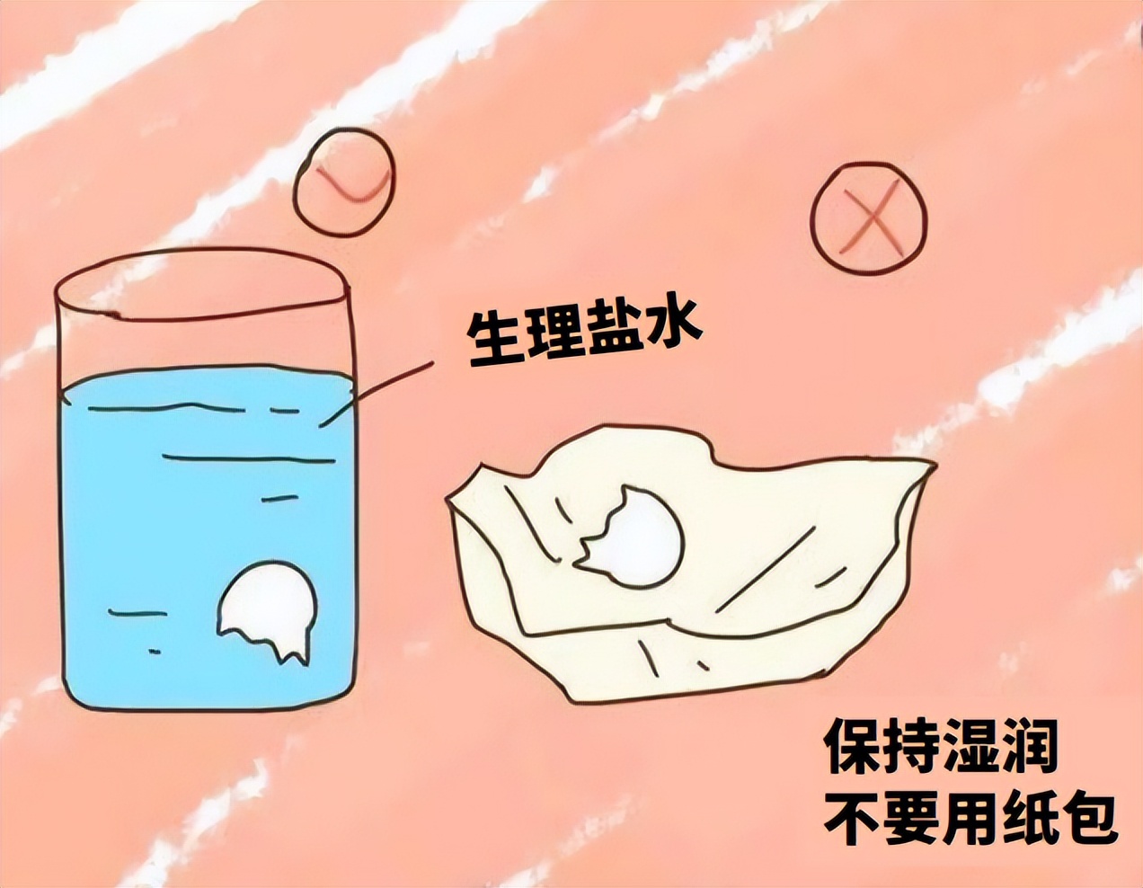 摔了一跤牙碰了半年还隐隐痛,摔了一跤牙齿磨掉了