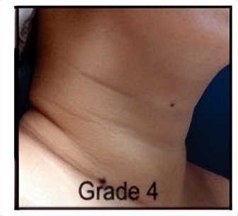 不要让颈纹出卖了你的年纪,不要让颈纹出卖你的年纪