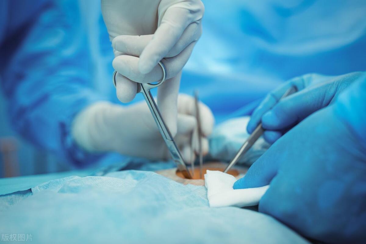 肛周脓肿疼痛等级1-12级是什么,肛周脓肿疼痛剧烈怎么办