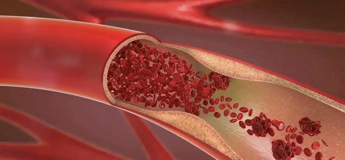 全球不到100例的疾病,史上最罕见的熊猫血