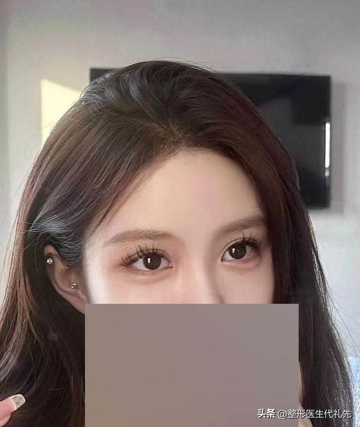 真正的卧蚕和眼袋到底有什么区别,卧蚕和眼袋的区别到底是什么