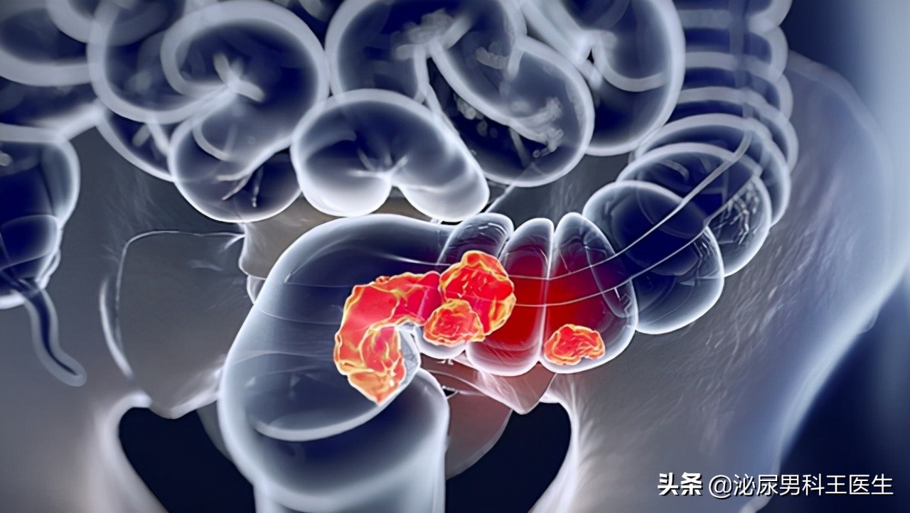 肛门瘙痒潮湿有分泌物怎么治疗,肛门潮湿还痒是什么症状