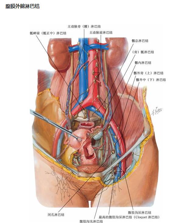 子宫全切？淋巴转移？宫颈癌手术方式有哪些？一文解析