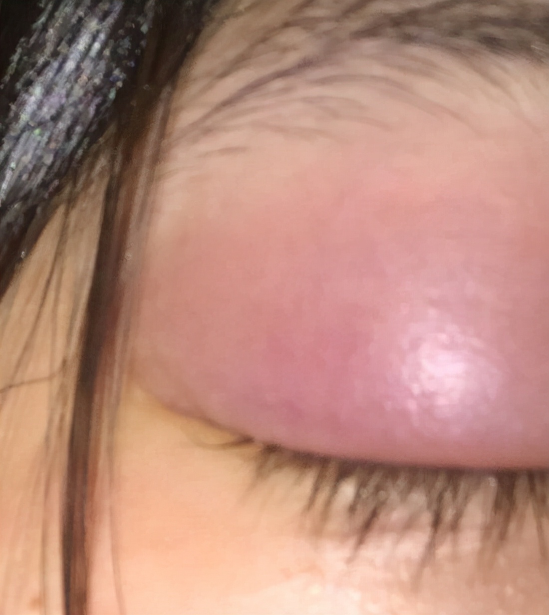 肾病用中医会伤肾吗,女人肾病怎么治