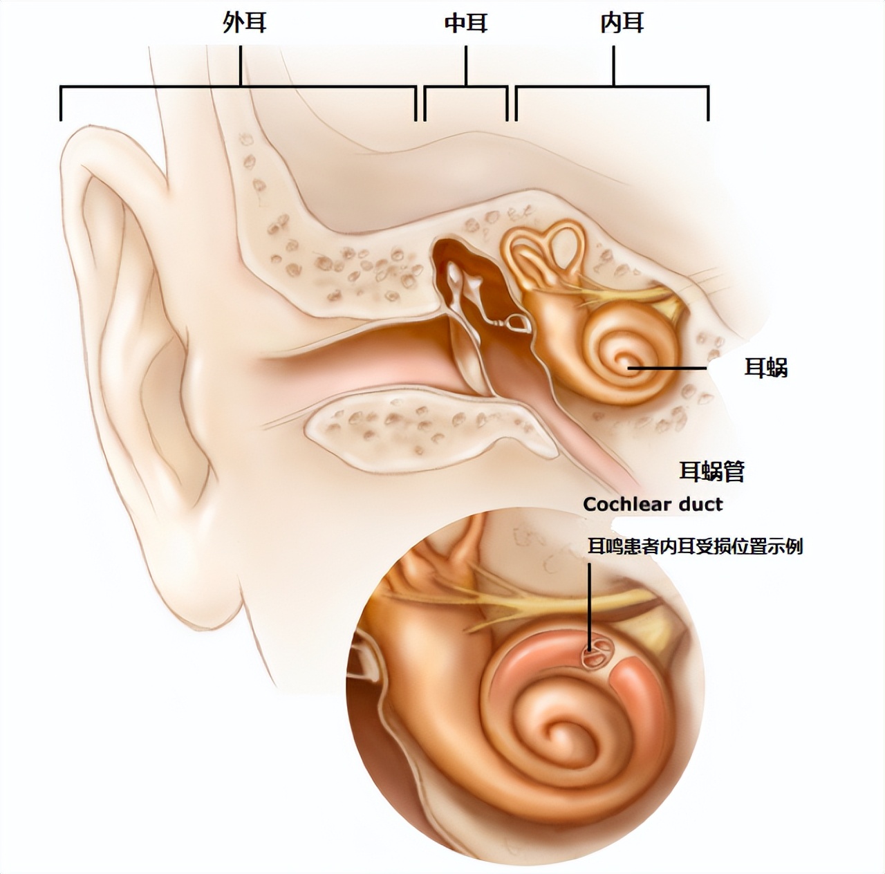 持续耳鸣耳朵嗡嗡响怎么回事,耳鸣耳朵嗡嗡响是怎么回事怎么治