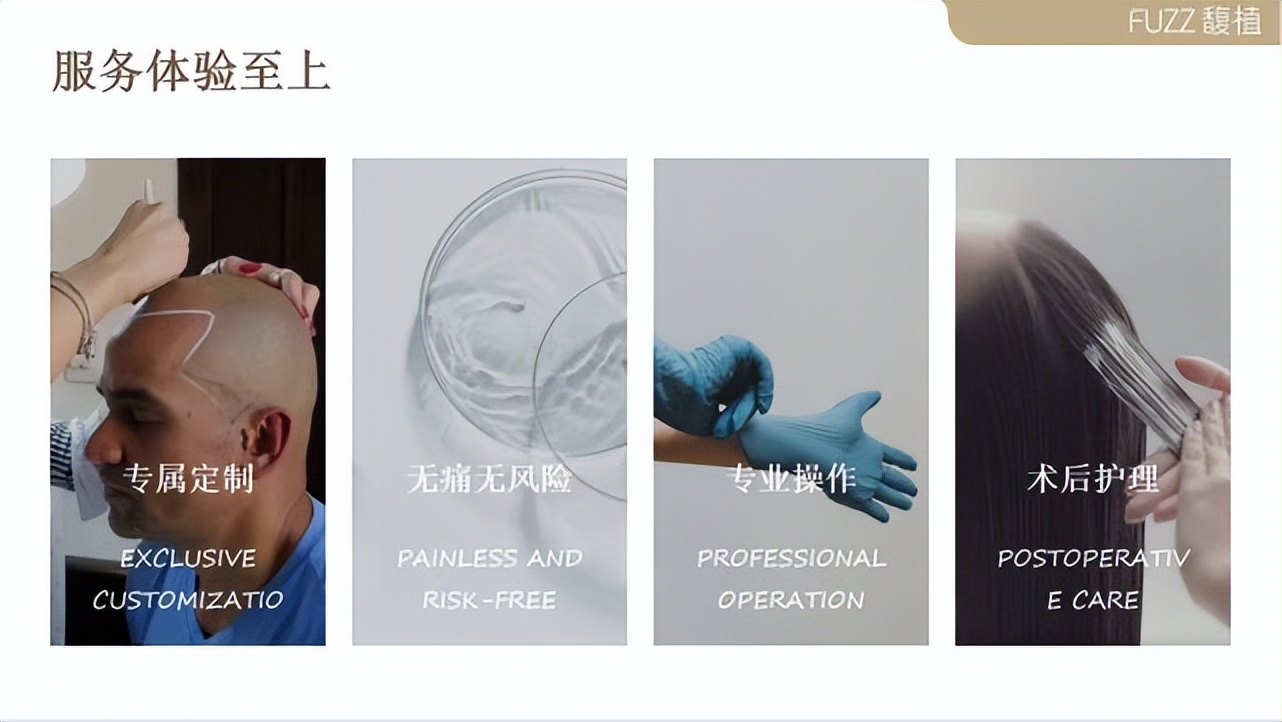 秃顶遗传还能拯救吗,秃顶有什么发型拯救