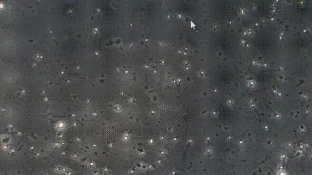 广东人类精子库地址,广东人类精子库