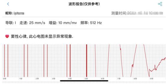 血压手表正确佩戴方式,智能手表血压准确便宜的