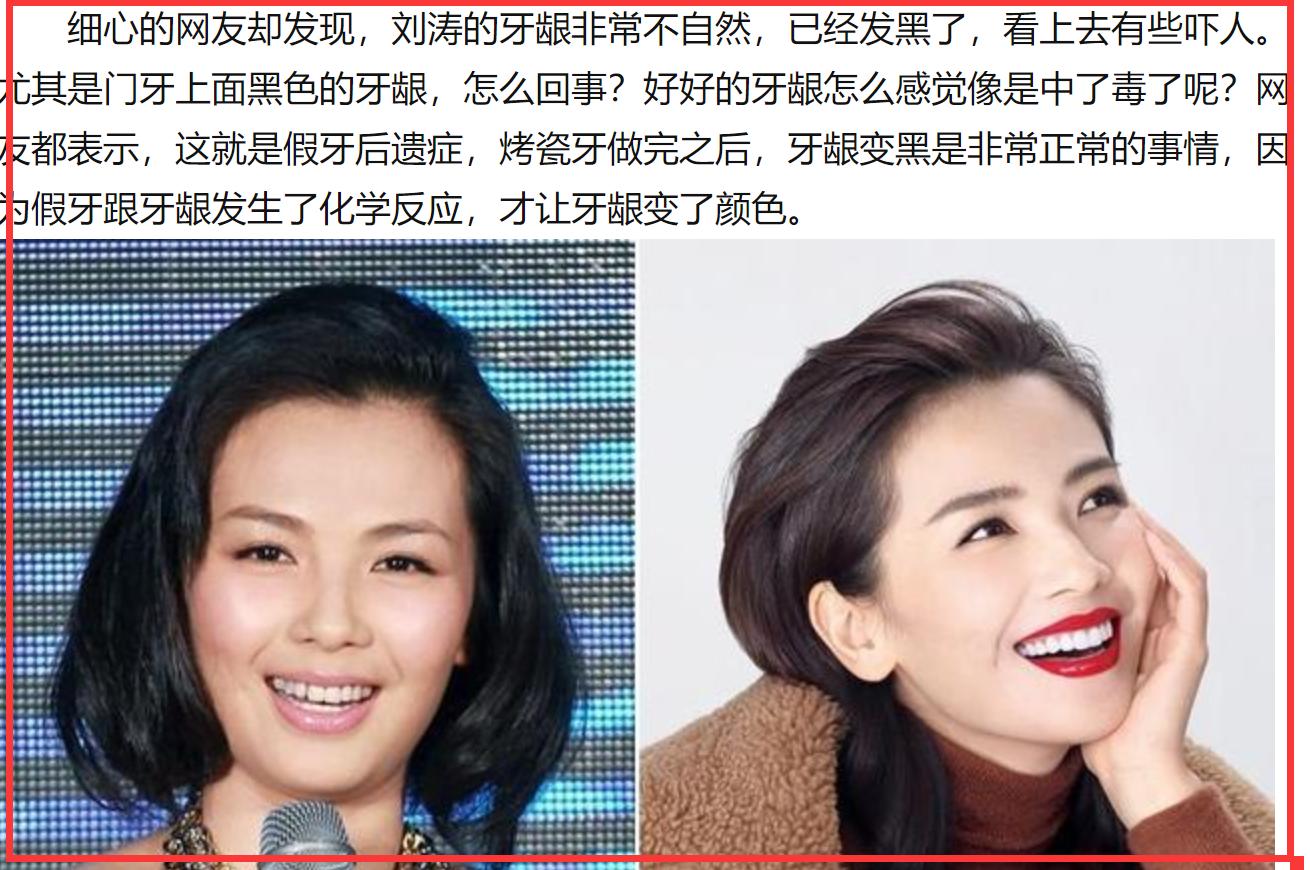 衣不蔽体,全身涂白,满口假牙闪瞎眼…娱圈的病态审美,该管管了