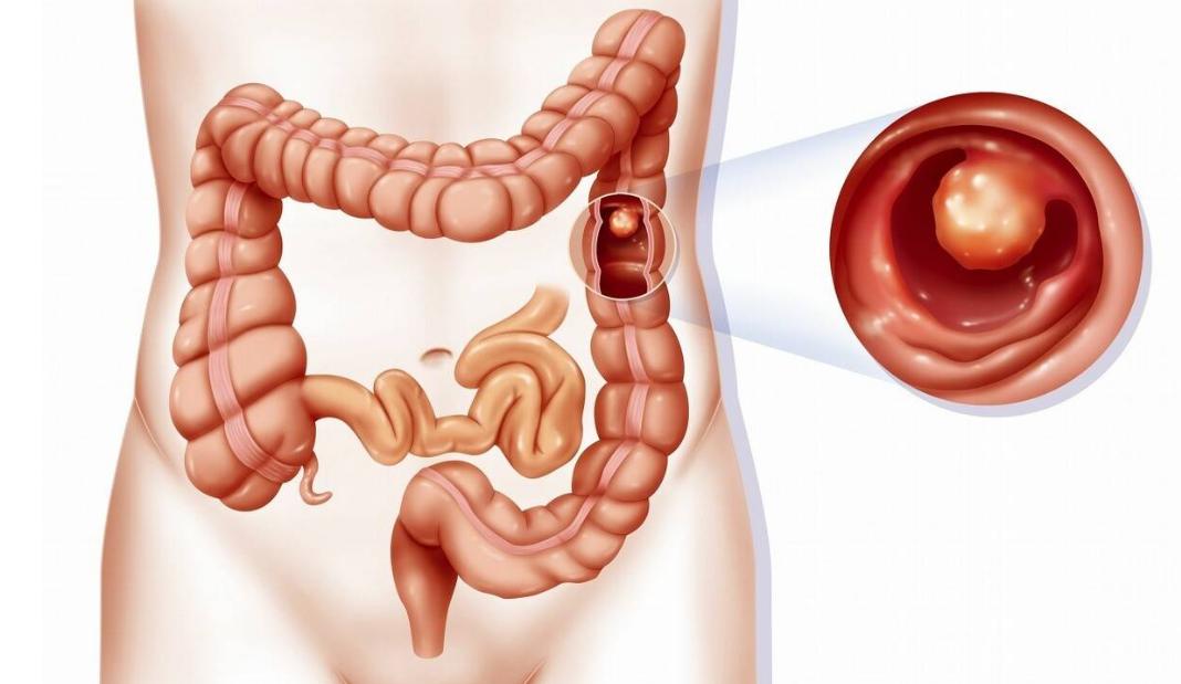 大便前头干硬后头软粘的原因,大便前头干硬后软是什么原因
