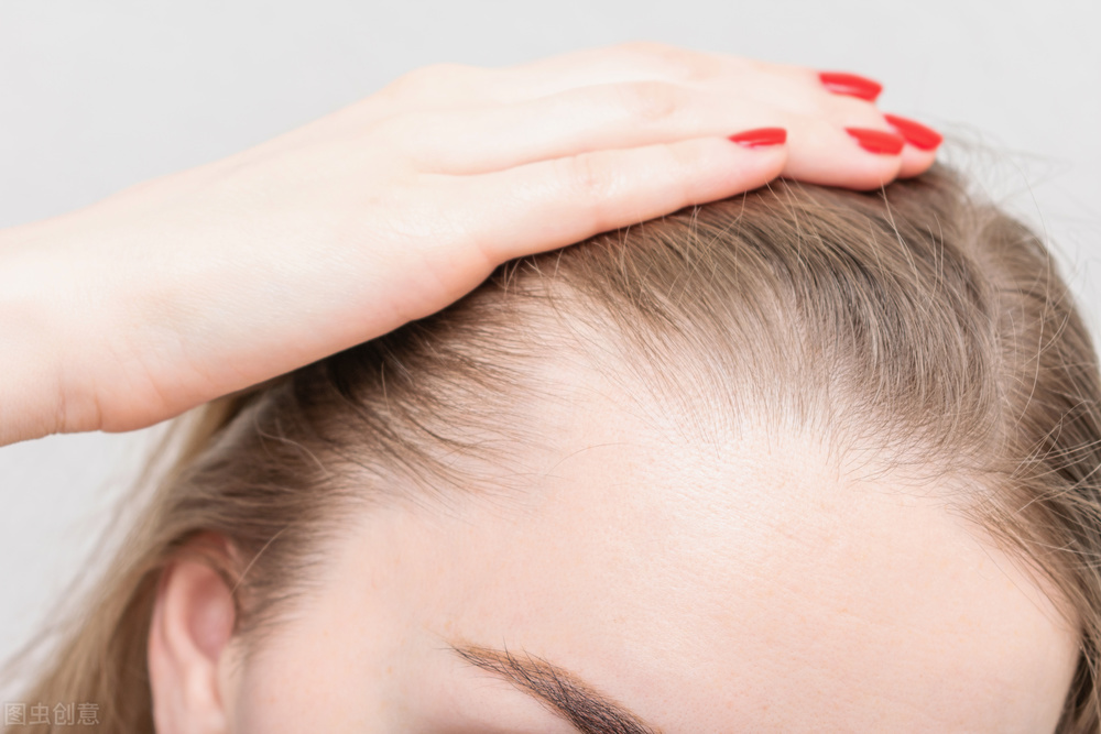 这9种情况告诉你为什么脱发困扰从古至今，有哪些医学方式治疗？
