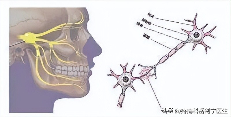 三叉神经痛如何鉴别诊断呢,三叉神经痛真实视频
