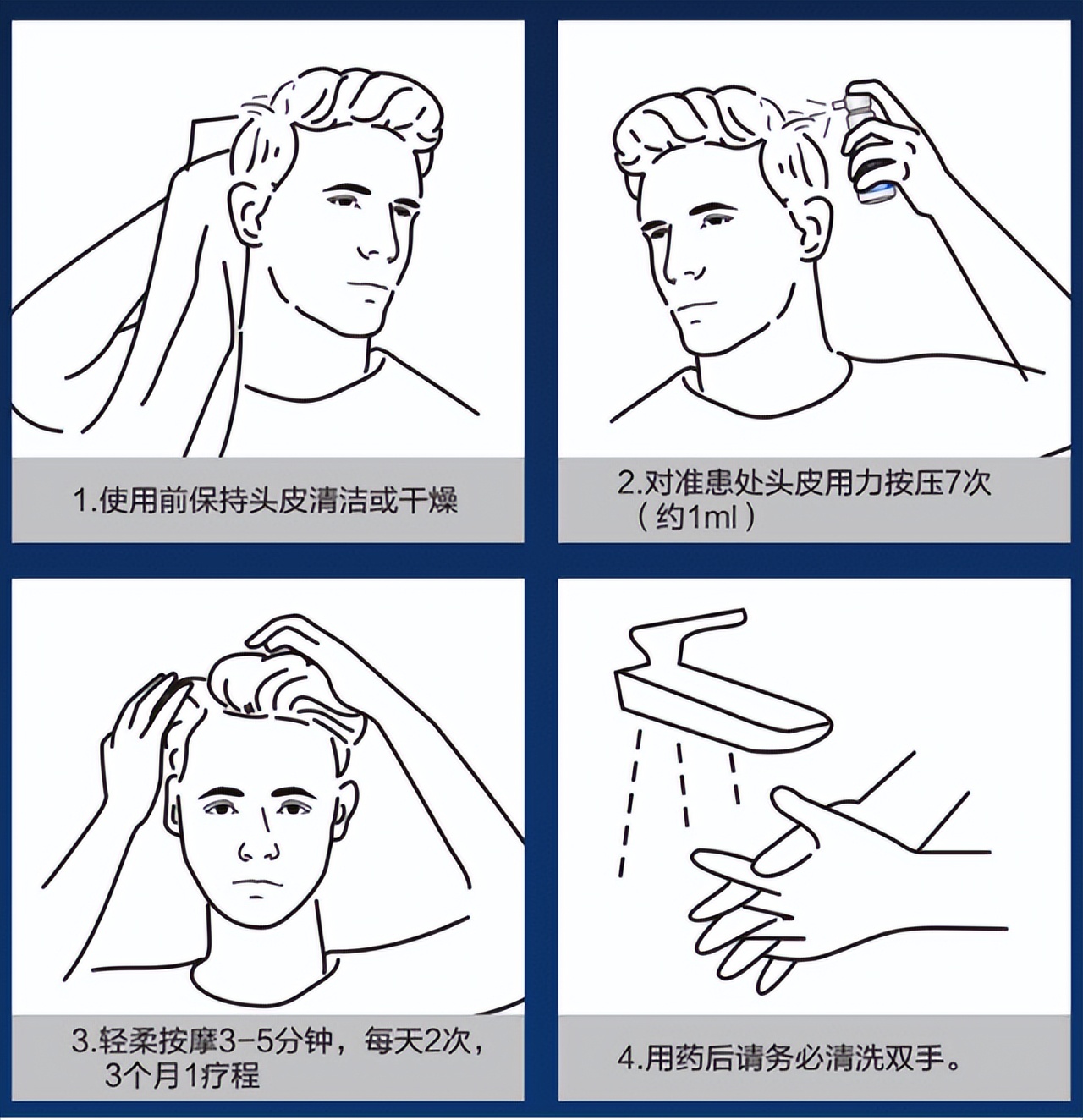 脱发发根有小白点严重怎么改善,脱发秃顶怎么办快速生发10天见效