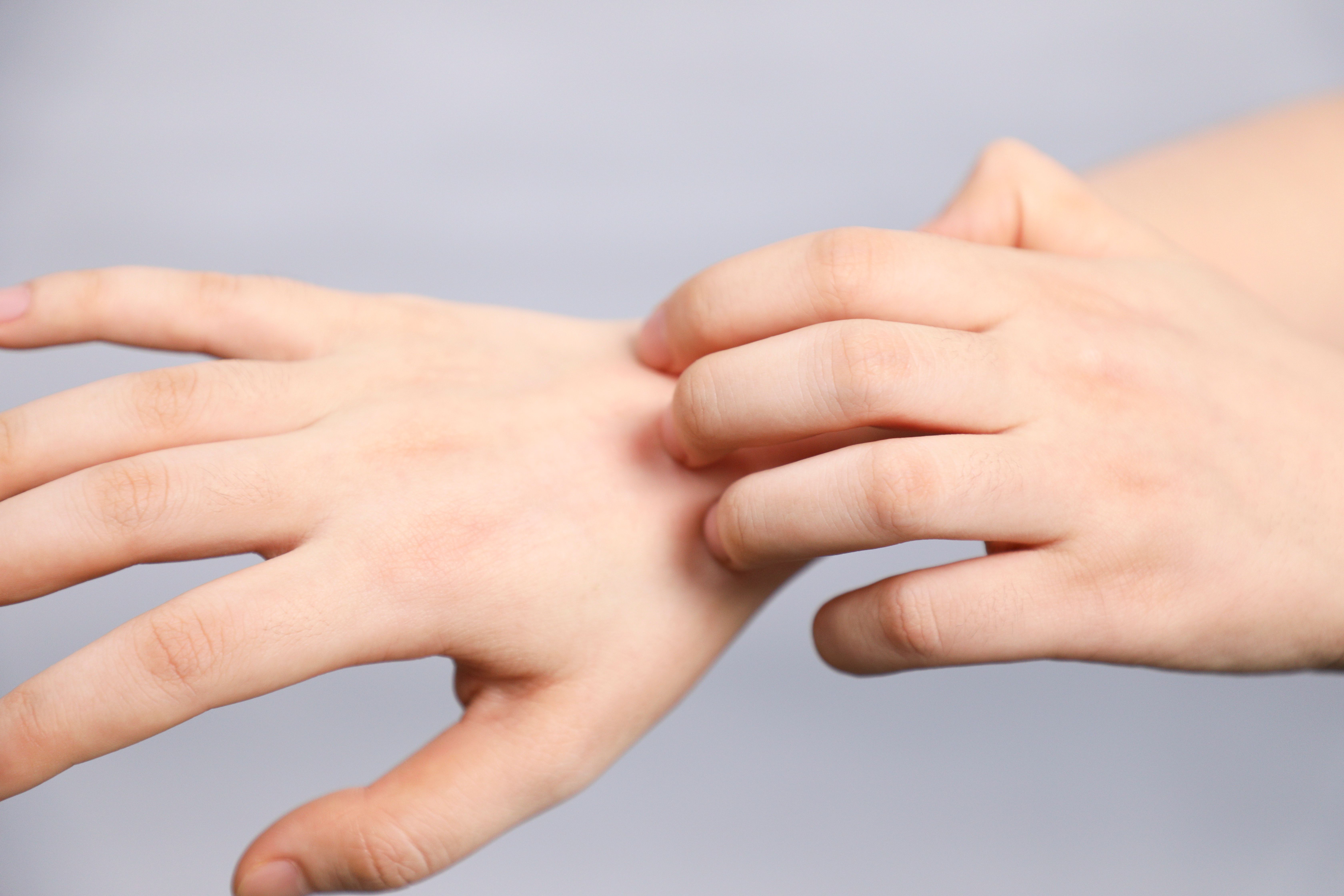 手脚长大小都有的水泡,手脚起小水泡脱皮用什么药