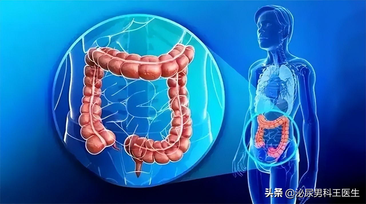 直肠癌的6个早期症状是一起出现,直肠癌出现便秘早期还是晚期