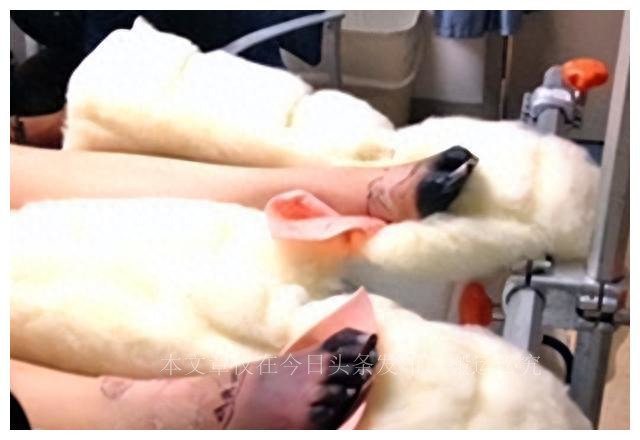 因为卫生棉条截肢的女孩,因卫生棉条截肢