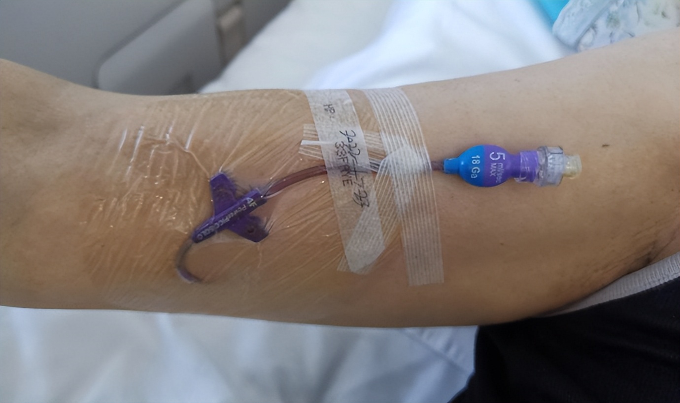 picc置管适用人群,picc置管自己能护理吗